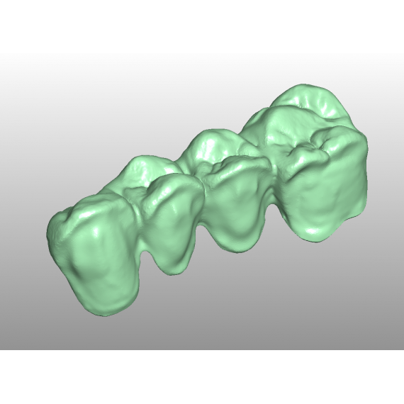 Zirconio Plus multistrato da file (consigliato per corone anatomiche)