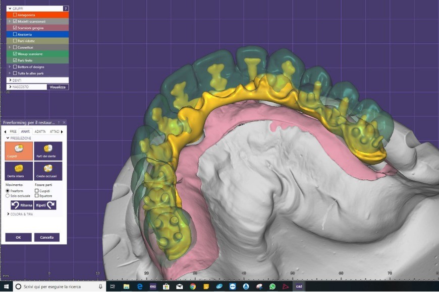 Exocad: la soluzione completa per l'odontoiatria digitale