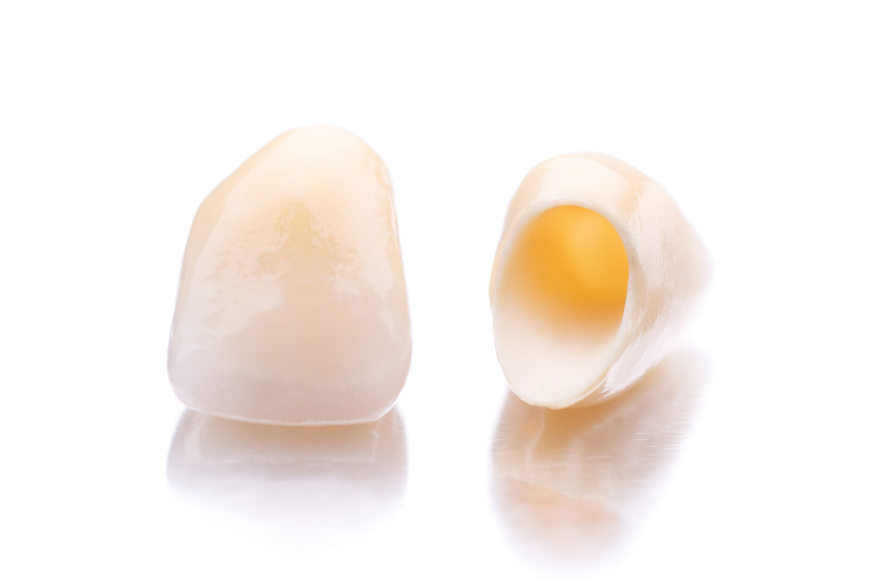 Corone zirconio ceramica: caratteristiche e vantaggi