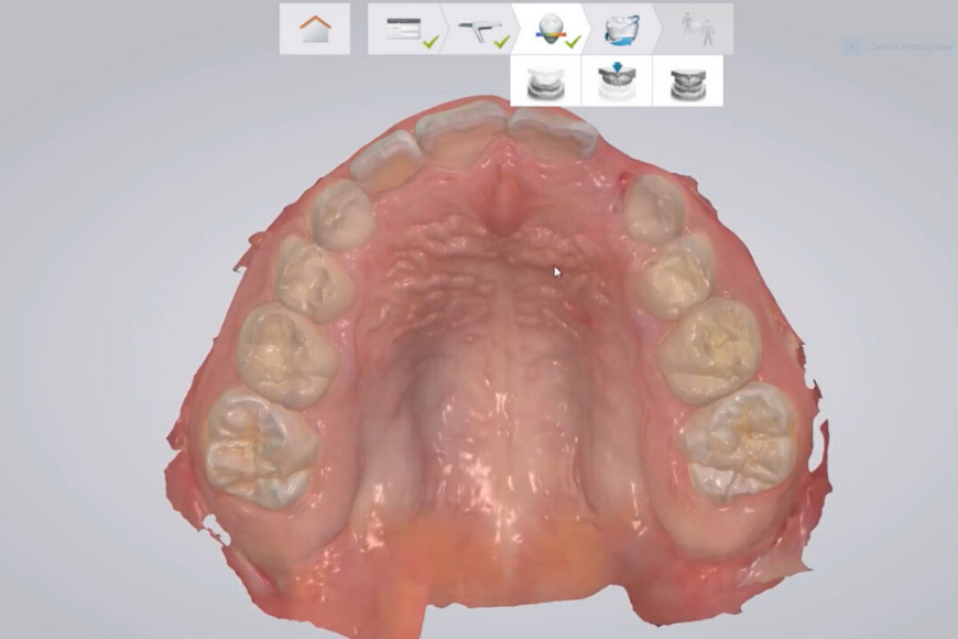 Impronta dentale digitale: caratteristiche e vantaggi 