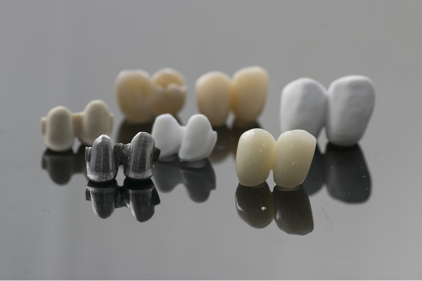 Materiali per corone dentali: i migliori e più affidabili 
