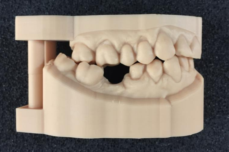 Modelli dentali: caratteristiche